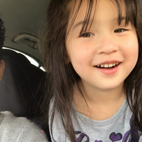 手首痛いの画像