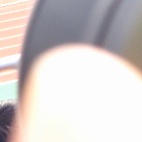 インフルエンザA型 の画像