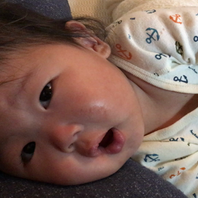 ウエスト症候群  こーちゃんの発作 動画の画像