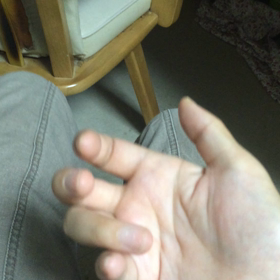 てんかんの動画…ですの画像