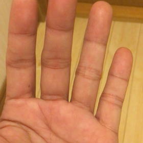 見て  イヤ  診て！の画像