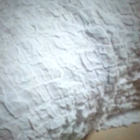 逆くしゃみの画像