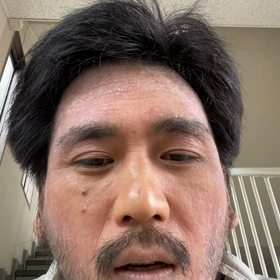 あんたに？の画像