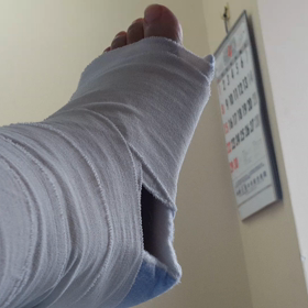 リハビリの画像