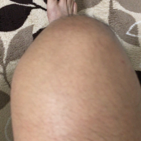 リハビリメニュー④の画像