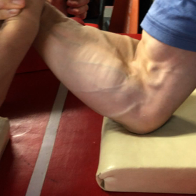 城君の腕の画像