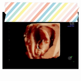 初めましての我が子の画像