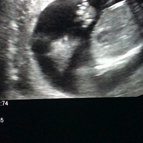 お久しぶりです　16w 4dの画像