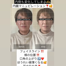 AGOメソッド山梨(^^)内臓マニュピレーションの画像