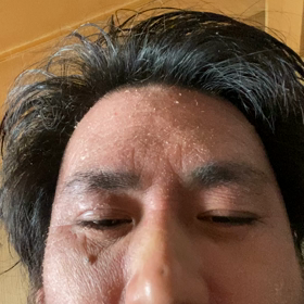 失禁ノットの画像