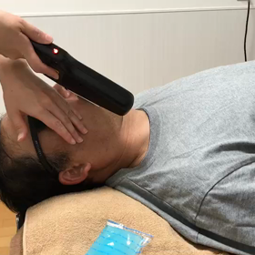 男性顔脱毛の画像