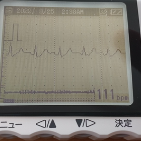 明け方の頻脈の画像