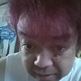 a9ジムの怪我の画像