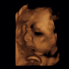 ”決心”4年前の出来事の画像