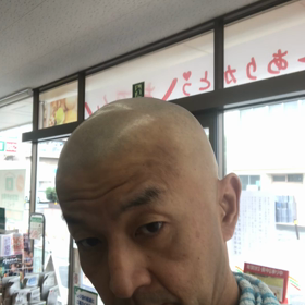 ハゲピッカピカの画像