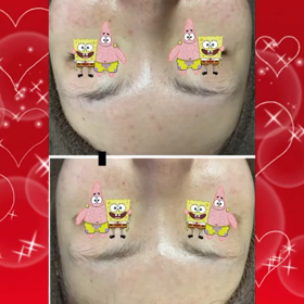 陶肌トリートメントの画像