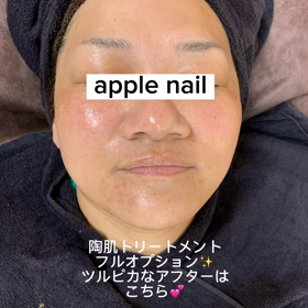 陶肌トリートメントフルオプション☆apple nailの画像