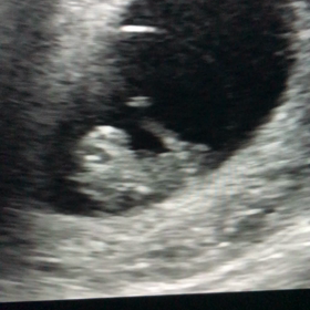 エコー動画　9w1dの画像