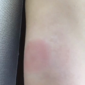 恒例のぷっくりの画像