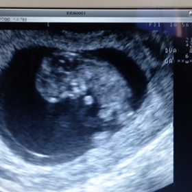 11w2ｄ☆ 動画の画像