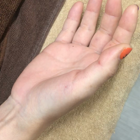 私達のリウマチ治す誓い！痛いなら今なの！　byなるりえの画像