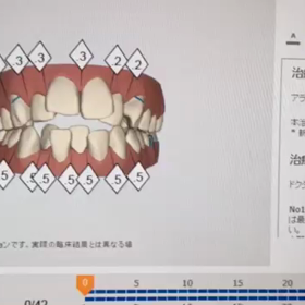 型取り後の画像