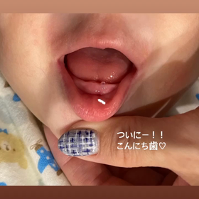 【8m5d】こんにち歯の画像