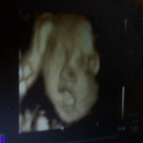 4Dエコー動画の画像