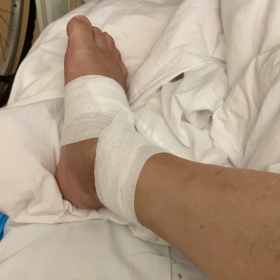 20200903転落事故から25日目✩.*˚✩.*˚術後11日目の画像