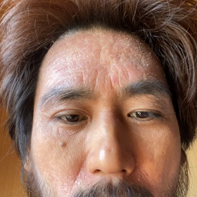 まばたき犯罪ばれの画像