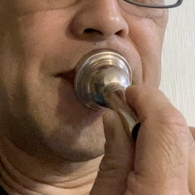 マウスピースを当ててみた2の画像