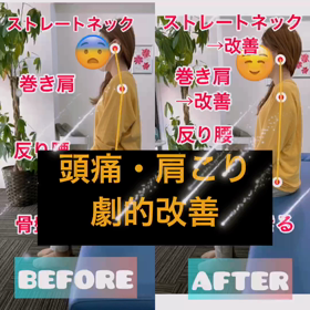頭痛・肩こり劇的改善✨✨の画像