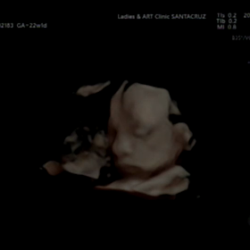 22週目の検診！テレワークの影響が…の画像