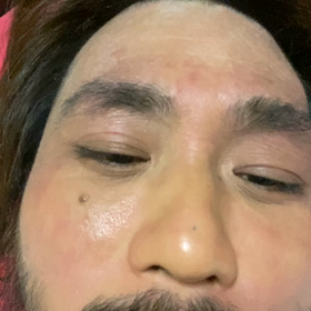 残りの門題の画像