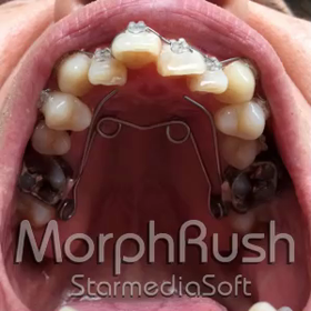 今度は上あごが広がる動画の画像