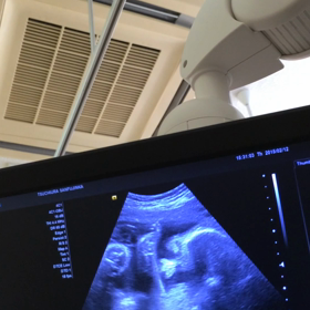 妊娠30週の画像