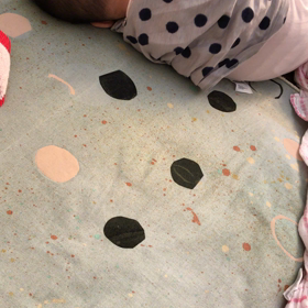 生後６ヶ月  右腕の変化…の画像