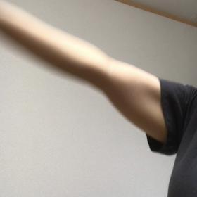 術後１ヶ月の画像