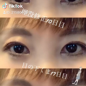 埋没から10日の画像