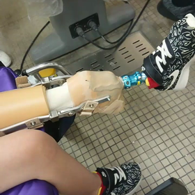 義足で歩く練習(動画)の画像