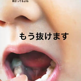 乳歯の画像