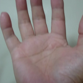 小指がバネ指の画像