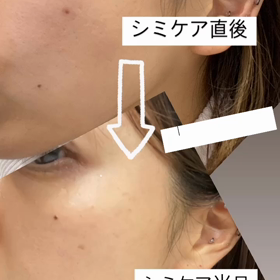 シミケアといえば浜北のソアリ♡！の画像