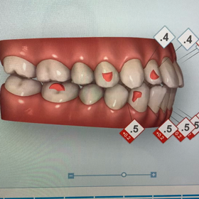 歯並びを良くしたい方の画像