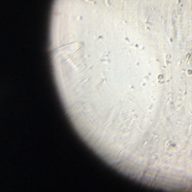 フーナーテスト 自宅にての画像