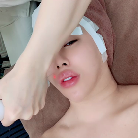 その日によって痛みの感じ方が違う、『レーザートーニング』の画像