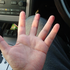 指の独立した動きの画像