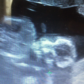 16w4d＊待ちに待った健診日の画像