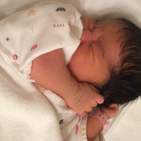 吸引分娩の頭の画像