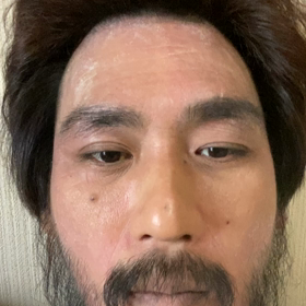 かさあかの画像